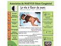 Naevus Géant Congénital - ANGC Association du Naevus Géant Congénital