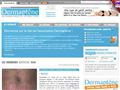 Dermaptène, informations patient en dermatologie, sur les allergies (dermato-allergologie)